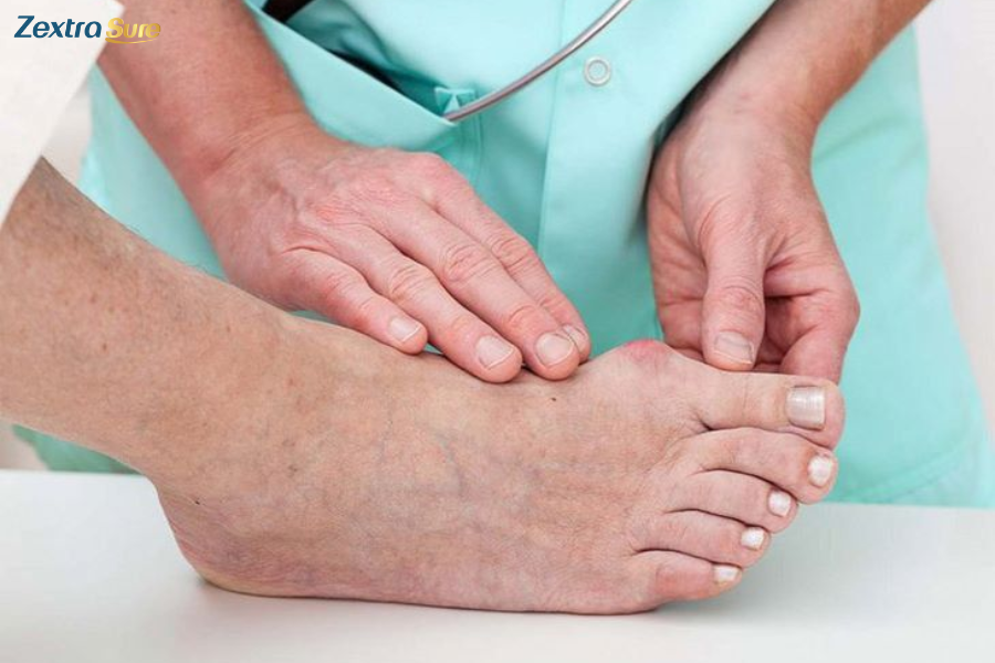 Contact healthcare professionals if you notice signs of swelling and pain on top of the foot